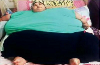 World's Heaviest Woman Comes to India for Her Treatment Tomorrow