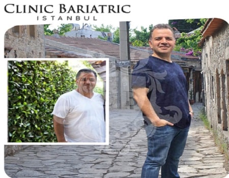 Clinic Bariatric Istanbul