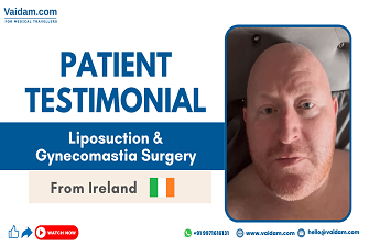 Patrick din Irlanda este tratat cu succes pentru ginecomastie (sânii de bărbat)