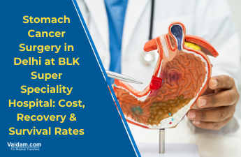 Stomach Cancer Surgery in Delhi at BLK Super Speciality Hospital: Cost, Recovery & Survival Rates